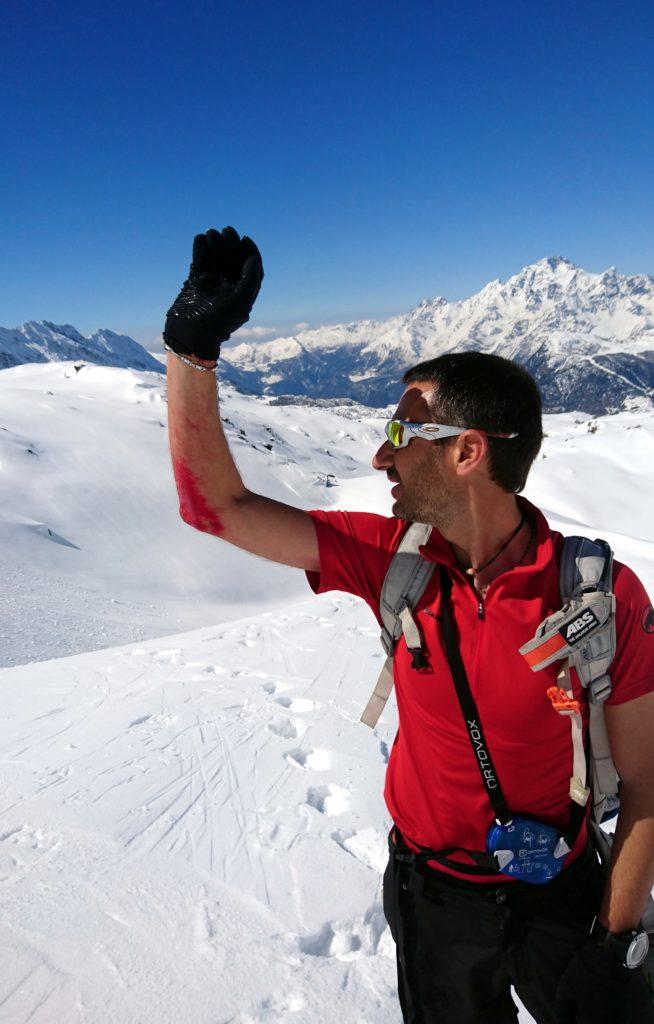 Il Gallo ha pagato pegno sul pendio ripido. La splitboard ha preso ad andare all'indietro e si è preso una bella grattugiata di gomito!