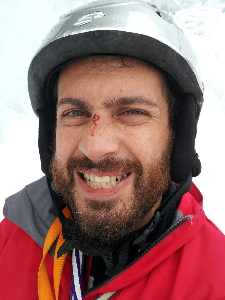 Ferita di guerra del Nig causata da scheggia di ghiaccio finita sul naso per aver martellato come un fabbro Ferita di guerra del Nig causata da scheggia di ghiaccio finita sul naso per aver martellato come un fabbro